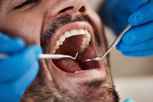 Best Urgent Care for Lost Fillings or Crowns in Medpolis, IA
